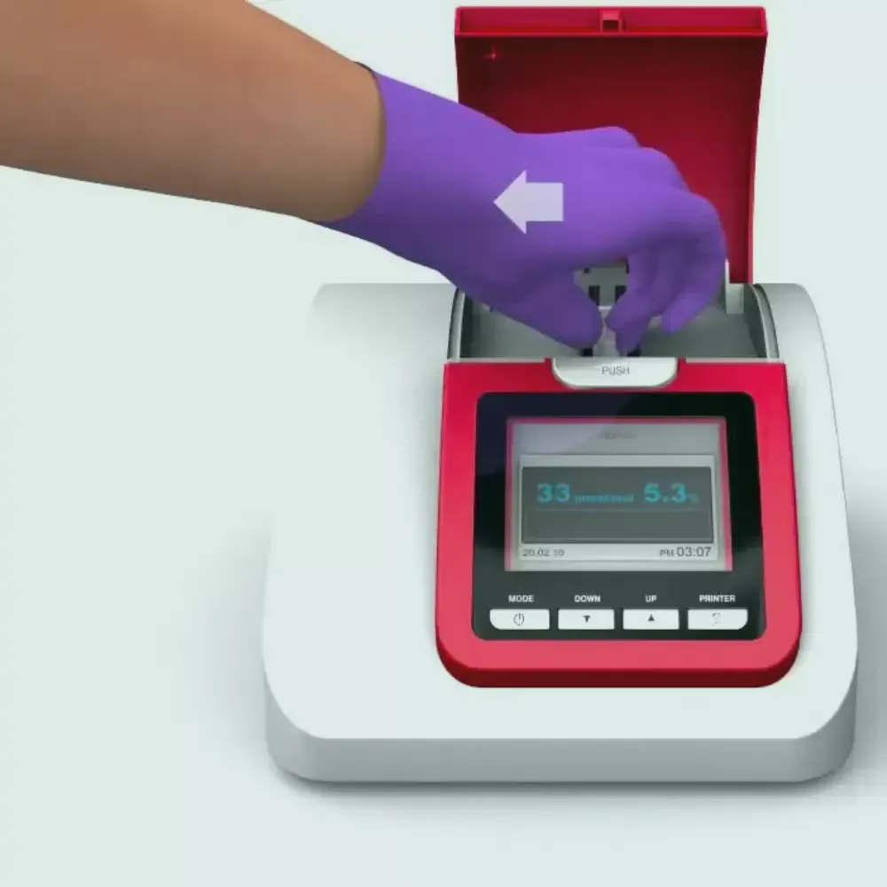 Hbg-c - Hemoglobină glicozilată